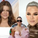 Khloe Kardashian zbulon të gjitha operacionet plastike që ka kryer