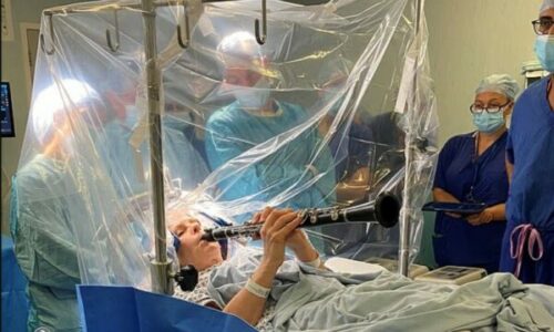 Pacientja me Parkinson luan klarinetë gjatë operacionit në tru që mjekët të vëzhgonin efektin e menjëhershëm të ndërhyrjes