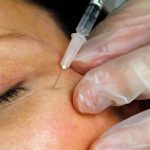 Lëshohen paralajmërime për rreziqet e fillerëve të fytyrës