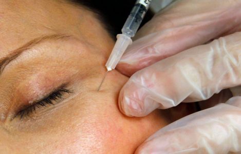 Lëshohen paralajmërime për rreziqet e fillerëve të fytyrës