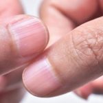 Ndryshimet në thonjtë tuaj mund të tregojnë probleme serioze shëndetësore, reagoni në kohë