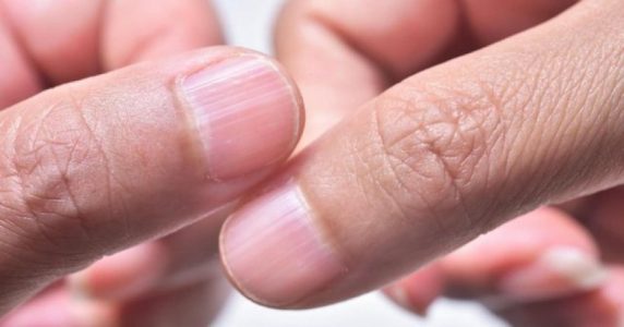 Ndryshimet në thonjtë tuaj mund të tregojnë probleme serioze shëndetësore, reagoni në kohë