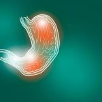 Perimet që largojnë fryrjen e stomakut