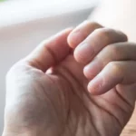 Pesë shenja që ju japin duart kur keni problem me tiroiden