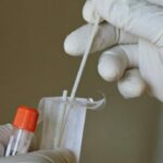 IKSHPK: Këtë vit u regjistruan 19 raste të reja me HIV/AIDS në Kosovë, një vdekje