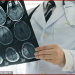 Testet gjenetike që mungojnë për tumoret e trurit