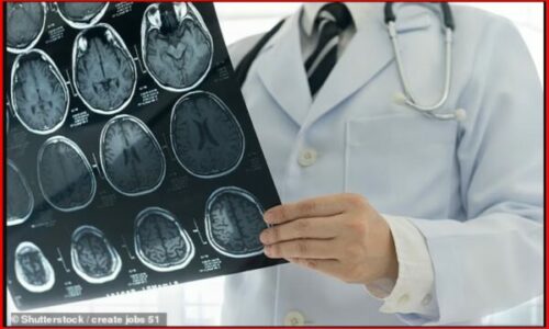 Testet gjenetike që mungojnë për tumoret e trurit