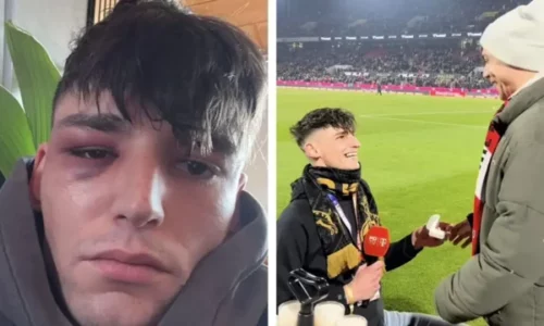 Referi gjerman rrihet keq pas propozimit publik për martesë që ia bëri partnerit të tij