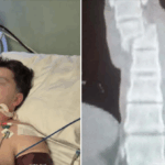 I riu nga Lipjani aksidentohet rëndë me motor – kërkohet ndihmë urgjente për t’i mbuluar shpenzimet mjekësore