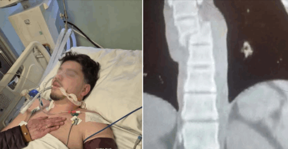 I riu nga Lipjani aksidentohet rëndë me motor – kërkohet ndihmë urgjente për t’i mbuluar shpenzimet mjekësore